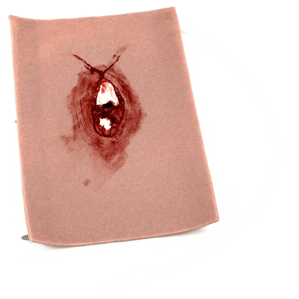 Sårmarkörskada öppen femurfraktur, realistisk modell med blodig skada för övningar med Combat Application Tourniquet.